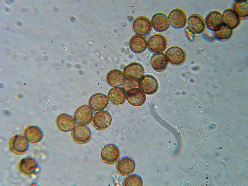 Metatrichia vesparium?